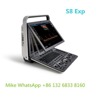 Harga Distribusi Tunggal <span class=keywords><strong>Sonoscape</strong></span> <span class=keywords><strong>S8</strong></span> <span class=keywords><strong>EXP</strong></span> Ultrasound di Seluruh Dunia - Product Image 2