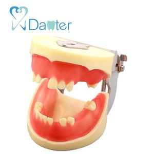 China Vervaardigen Tandheelkundige Model <span class=keywords><strong>Implant</strong></span> Practice Model met Siliconen Gingivae voor Student Praktijk - Product Image 2