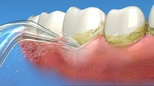 Irrigador Bucal Recargable con Soporte OEM, Rotación y Pulsación, Presión de 75-125 Psi, 2 Semanas de Duración de la Batería, para Limpieza Dental - Product Image 6