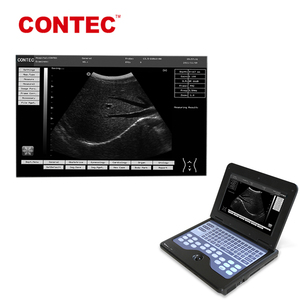 CONTEC CMS600P2 Échographe <span class=keywords><strong>Doppler</strong></span> portable numérique pas cher de 10,1 pouces, prix - Product Image 3
