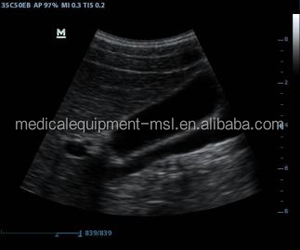 Mindray DP-10 Ecografa Draagbare <span class=keywords><strong>Ultrasound</strong></span> <span class=keywords><strong>Machine</strong></span> - Product Image 6