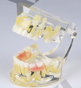 Mezcla de dentición modelo dental con los dientes permanentes y desdentado dientes de bebé y de retención - Product Image 1