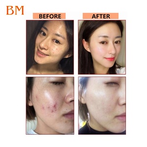 Miếng Dán Chân Thư Giãn Khử Mùi Hoa Hồng Bán Chạy Loại Bỏ Độc Tố Cải Thiện Giấc Ngủ Detox Miếng Dán Chân - Product Image 6