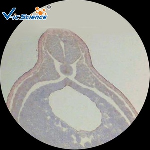 מיקרוסקופ מוכן שקופיות 11 יח 'מעבדה הוראה ביולוגית חינוכית שקופיות צפרדע פיתוח עובר שקופיות - Product Image 2