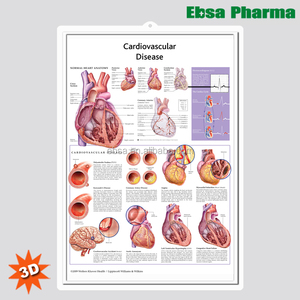 Breloques murales d'anatomie médicale 3D, affiche de lentilles cardiovaires - Product Image 1