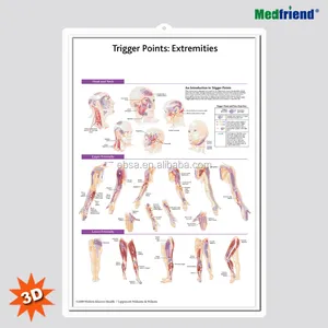 3D医療人体解剖学ウォールチャート/ポスター-トリガーポイント: 極値