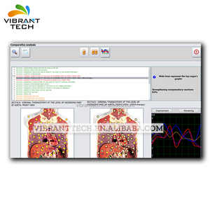 De Verificação de Saúde e Terapia bioressonância 25 3DNLS Metatron <span class=keywords><strong>Hunter</strong></span> <span class=keywords><strong>4025</strong></span> - Product Image 3