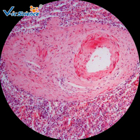 Microscope Prepared Slides 200pcs Human Pathology Slides for Medical Students Medical Science Pathology