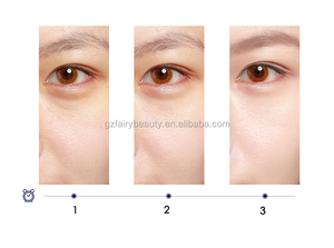 Crema de Ojos de Marca Privada para Bolsas Instantáneas, Hinchazón, Suavizante de Arrugas, Reafirmante, Efecto Lifting, Antiedad en 3 Minutos - Product Image 2