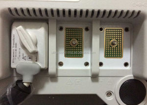 MSLCU25F <span class=keywords><strong>machine</strong></span> à ultrasons doppler Couleur/portable à ultrasons à écran tactile - Product Image 4