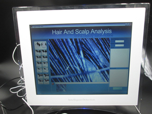 Beauty Center Use Hair Salon 200x Hair Density <strong>test</strong> <strong>Machine</strong> - Product Image 5