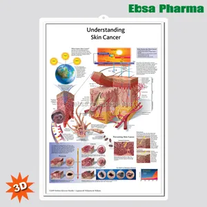 3D медицинские анатомические настенные таблицы/плакат-Понимание рака кожи