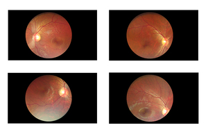 El sigara non-mydriatic <span class=keywords><strong>Retinal</strong></span> kamera - Product Image 5
