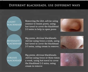 OEM ODM Bioaqua Mụn Đầu Đen Làm Sạch Sâu Làm Sạch Mụn Trứng Cá Mụn Remover Mặt Nạ Bùn Đen - Product Image 5