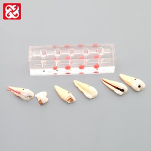 <span class=keywords><strong>Dental</strong></span> studio Modello di processo di trattamento endodontico <span class=keywords><strong>dental</strong></span> modello di l'educazione del paziente modello - Product Image 3