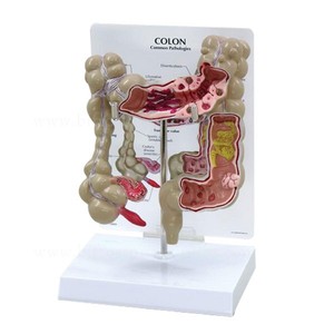Modelo de Colon para Patología, Órganos del <span class=keywords><strong>Cuerpo</strong></span> <span class=keywords><strong>Humano</strong></span>, Anatomía - Product Image 3