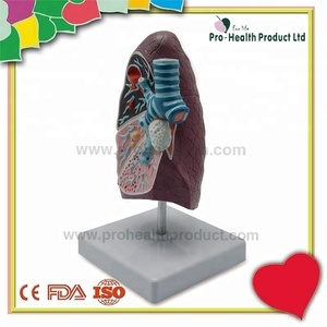 Modèle de poumon malade du système respiratoire en pathologie - Product Image 6