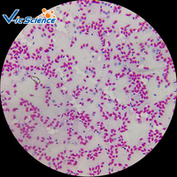 Microscope Prepared Slides Cheap Price Hematology Prepared Slides Blood Smear Microscope Accessories Slide Hematology