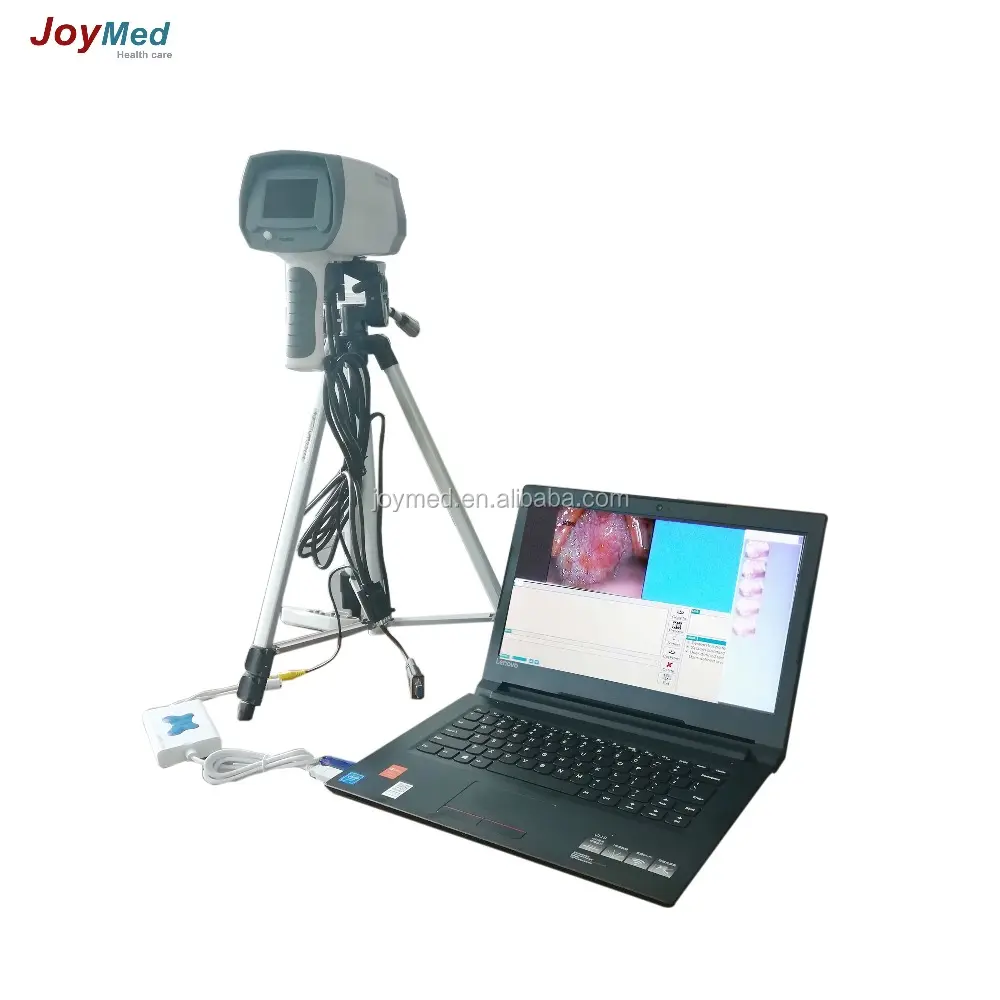 Цифровой видеоколоскоп, используемый в домашних или клинических условиях