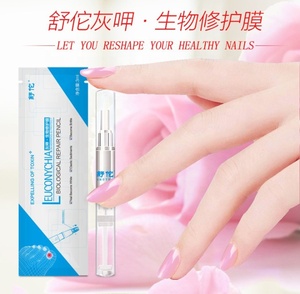 LOOKNICE - Pluma de Tratamiento para Onicomicosis y Paroniquia de Uñas, a Base de Hierbas Chinas, 3 ml, para Infecciones Fúngicas de Uñas - Product Image 6
