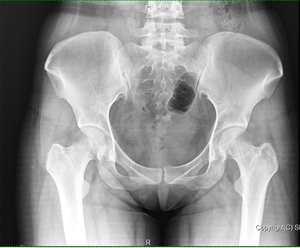 Iray 17X17 Bedrade Csi <span class=keywords><strong>Flat</strong></span> <span class=keywords><strong>Panel</strong></span> <span class=keywords><strong>Fpd</strong></span> X Ray <span class=keywords><strong>Detector</strong></span> - Product Image 3