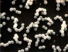 Inhibición de 200 mil millones de UFC/G de Helicobacter Pylori y reducción del colesterol por probióticos Limosilactobacillus Reuteri