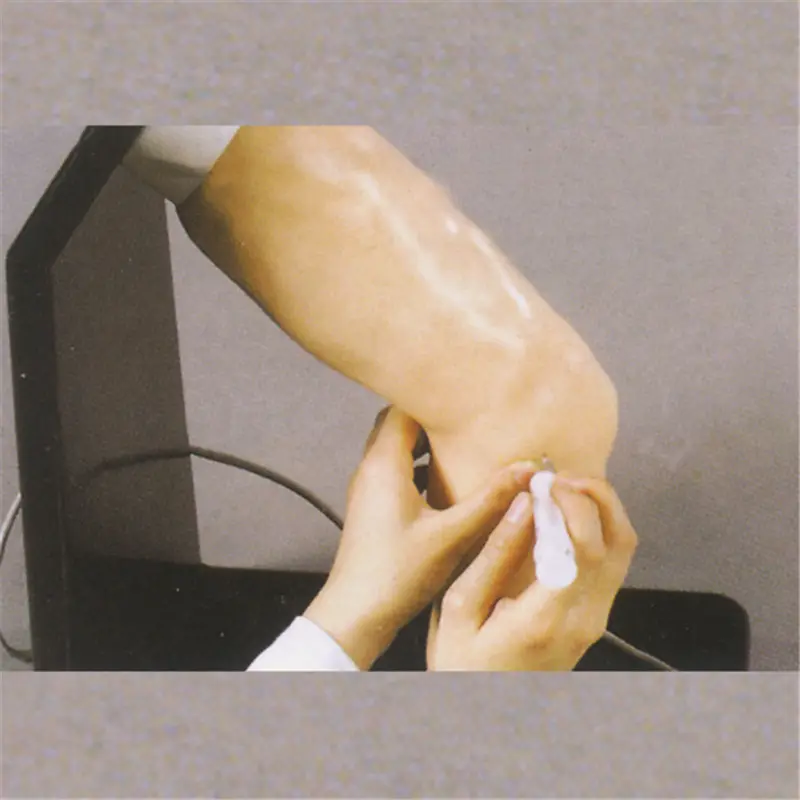 Medical elbow joint injection model BIX-CK20134