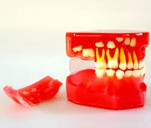 Dental tanden Graghically Tonen Ontwikkelen model