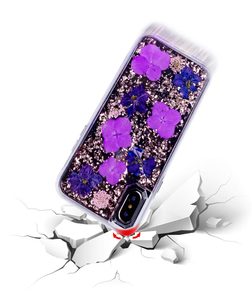 Commercio all'ingrosso di lusso copertura del telefono mobile per <span class=keywords><strong>iphone</strong></span> caso di <span class=keywords><strong>x</strong></span>, per <span class=keywords><strong>iphone</strong></span> caso di <span class=keywords><strong>X</strong></span> di lusso - Product Image 5