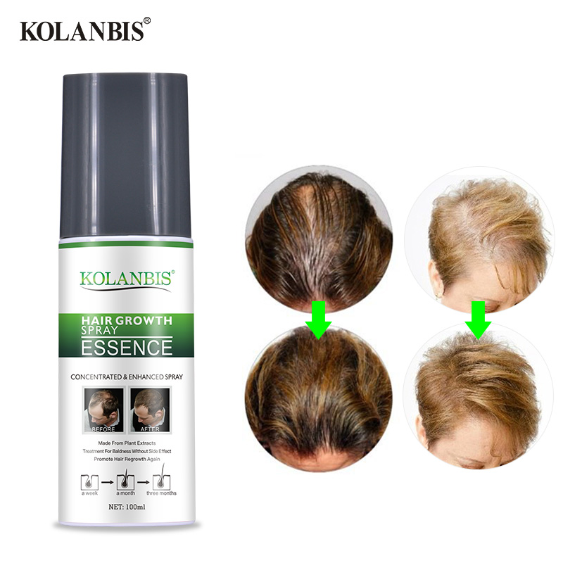 Thick Fast Hair Growth Serum For Women Men Scalp Treatment Repair Follicle Cure Baldness Anti Alopecia