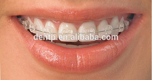 Orto SINO Crystal Clear Dental <span class=keywords><strong>Brackets</strong></span> cerámicos ortodoncia <span class=keywords><strong>Brackets</strong></span> cerámicos - Product Image 5