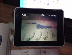 <span class=keywords><strong>Laryngoscope</strong></span> vidéo MY-G054C Prix <span class=keywords><strong>Laryngoscope</strong></span> vidéo Portable <span class=keywords><strong>Laryngoscope</strong></span> flexible - Product Image 3
