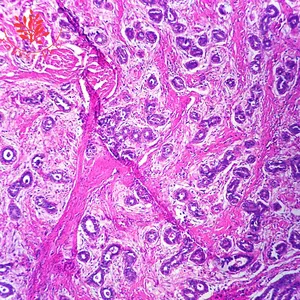 Frt2002 Dia Pathologie Geneeskunde Educatieve Menselijke Pathologie Microscoop Bereid Dia 'S