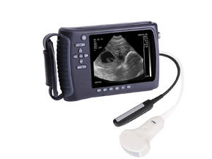 Recentemente Veterinaria Full Digital Ultrasound Scanner (<span class=keywords><strong>PL</strong></span>-3018V) - Product Image 3
