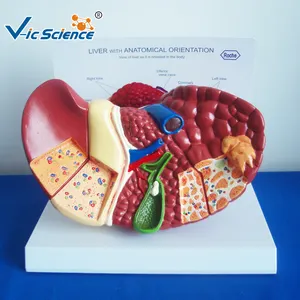 medical anatomical model Human liver cancel model, liver disease model,liver cancel medical science education model