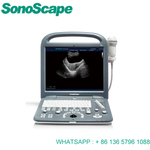 <span class=keywords><strong>Sonoscape</strong></span> <span class=keywords><strong>S2</strong></span> Portable <span class=keywords><strong>Sonoscape</strong></span> Usg Color Doppler Usg - Product Image 6