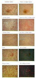 Analyseur de peau à caméra, appareil portable d'analyse de la peau, dermiques numérique - Product Image 5