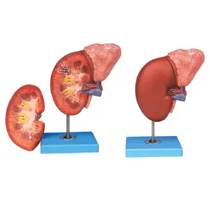 Kidney and Adrenal Gland Medical Model