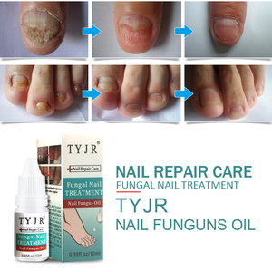 TYJR Soin des ongles Onychomycose Paronychie Traitement des champignons Nourrissant Réparateur Soin des ongles naturel biologique <span class=keywords><strong>Huile</strong></span> - Product Image 4