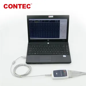 CONTEC8000G Tragbare 12 führt EKG Workstation