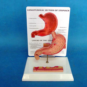 High Quality Human ulcer stomach model,Gastric ulcer model