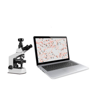 Sanwe SW-<span class=keywords><strong>3702</strong></span> Analisador da Qualidade do Esperma com câmara de contagem de esperma - Product Image 6