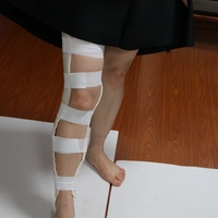 Attelle orthopédique rigide en thermoplastique pour le genou, la cheville et le pied, orthèse fixe