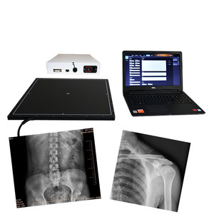 Digital X Ray Machine For Hospitals Alibaba 