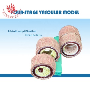<span class=keywords><strong>Arteriosclerosis</strong></span> <span class=keywords><strong>enfermedad</strong></span> cardiovascular 4 unidades patología humana arteria modelo - Product Image 4