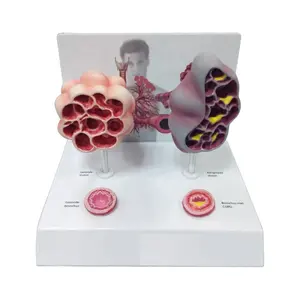 확대 폐 Lobule 모델 폐 폐포 - Product Image 1