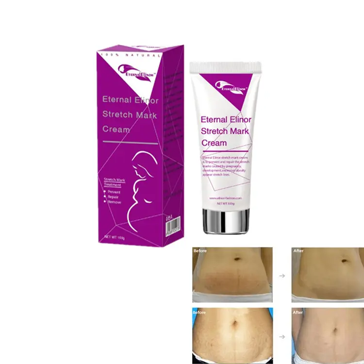 Eeuwige Elinor Na Zwangerschap Repareren Striae Crème Anti Stretch Mark Verwijderen Crème Rebranding