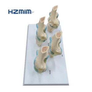 Modèle de genou pour l'arthrite, modèle des articulations du genou à 4 étages - Product Image 3