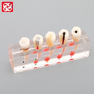 <span class=keywords><strong>Dental</strong></span> studio Modello di processo di trattamento endodontico <span class=keywords><strong>dental</strong></span> modello di l'educazione del paziente modello - Product Image 2