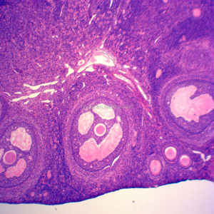 Histologie präparierte Objektträger / Eierstock von Hase sec Histologie präparierte Objektträger - Product Image 1